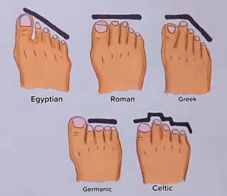 Koju vrstu stopala imate i da li ono zaista otkriva vaše porijeklo?