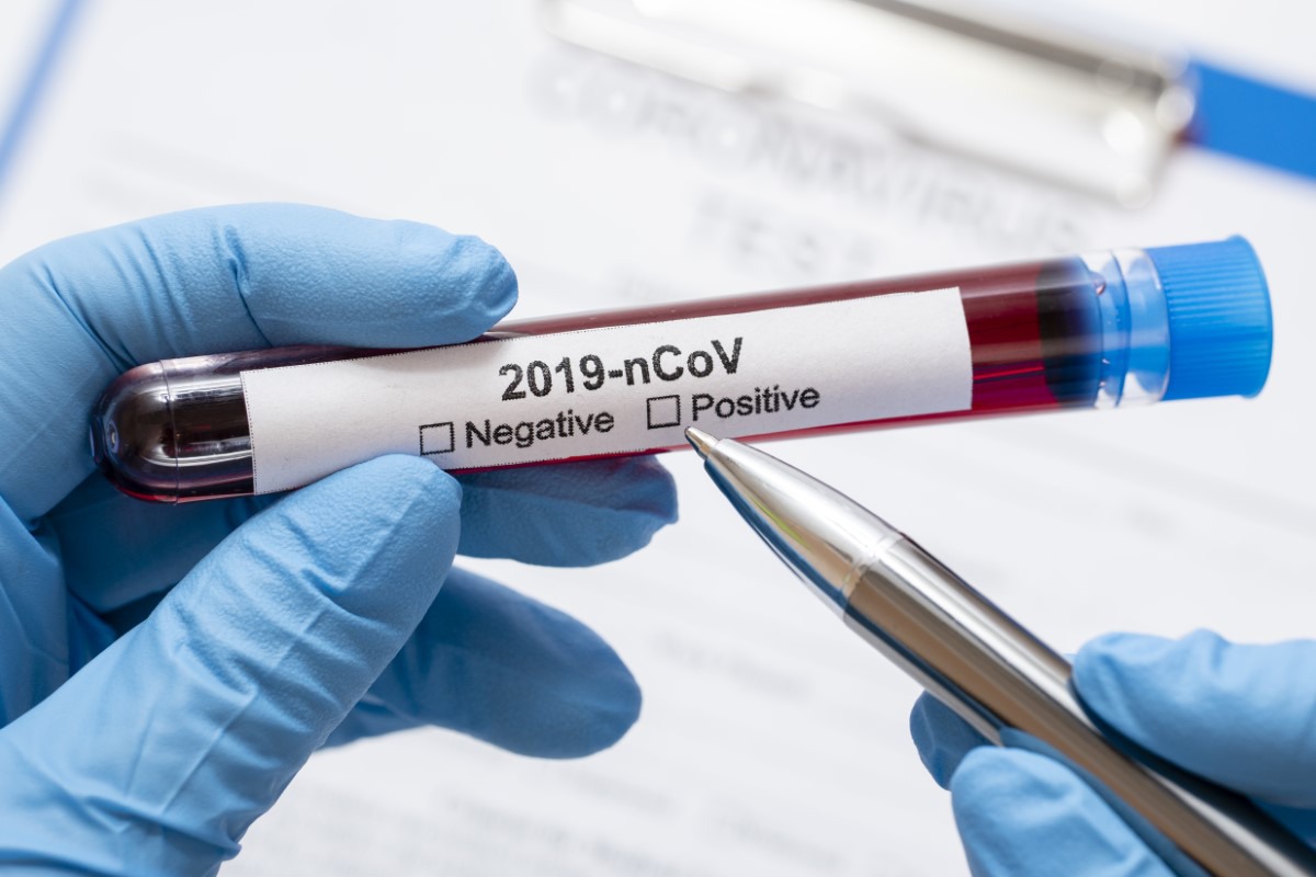 U RS testirano 595 uzorka, osam pozitivnih na koronavirus