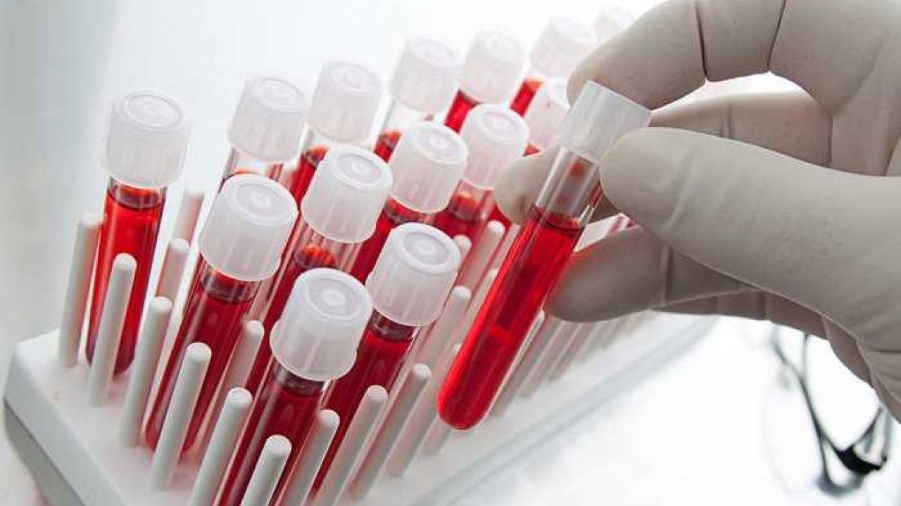 Italija pokreće krvna testiranja 150.000 ljudi