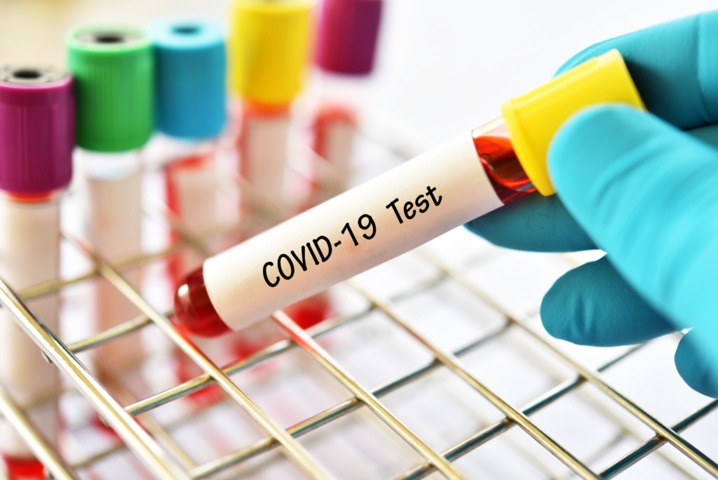 U FBiH 11 novih slučajeva koronavirusa