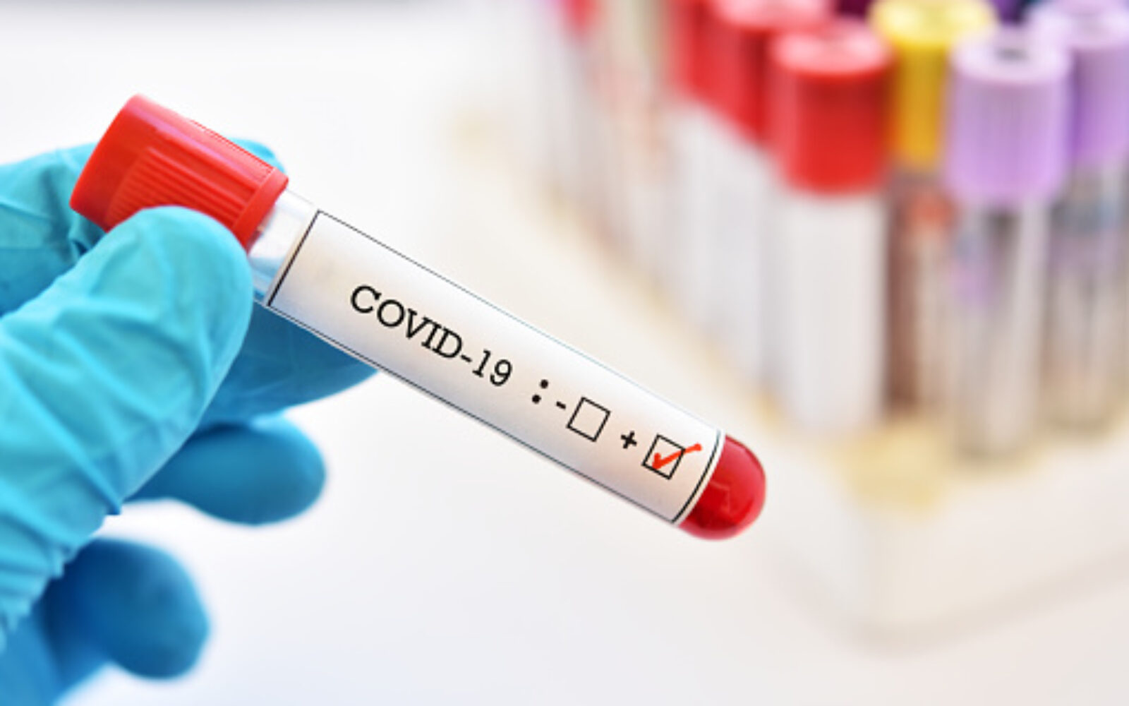 U RS koronavirus potvrđen još kod 14 osoba, jedan muškarac preminuo