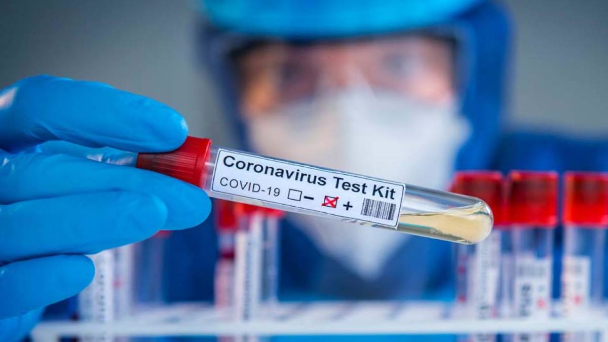 U RS koronavirus potvrđen kod još 27 osoba