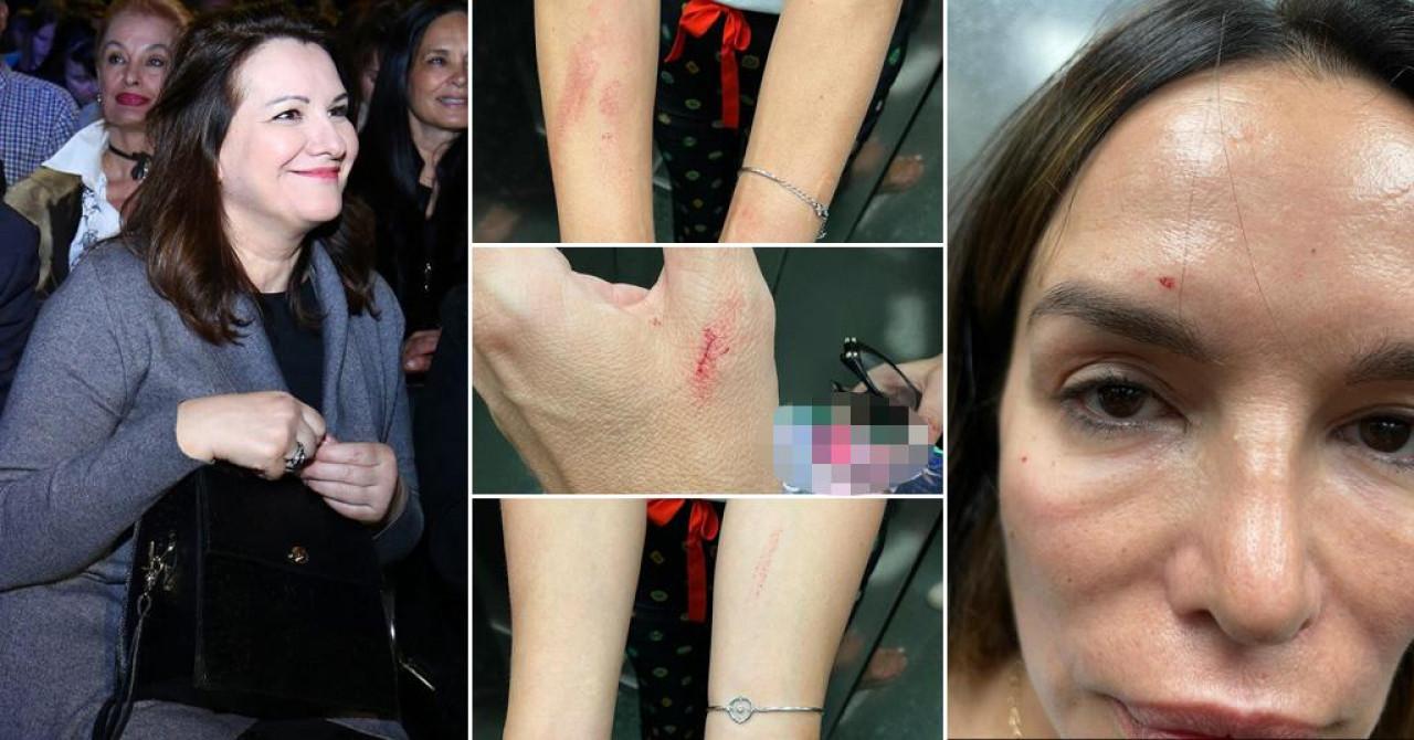 Policija uhapsila Severinu!