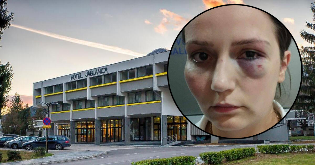 Potvrđena optužnica protiv vlasnika hotela Jablanica koji je pretukao radnicu